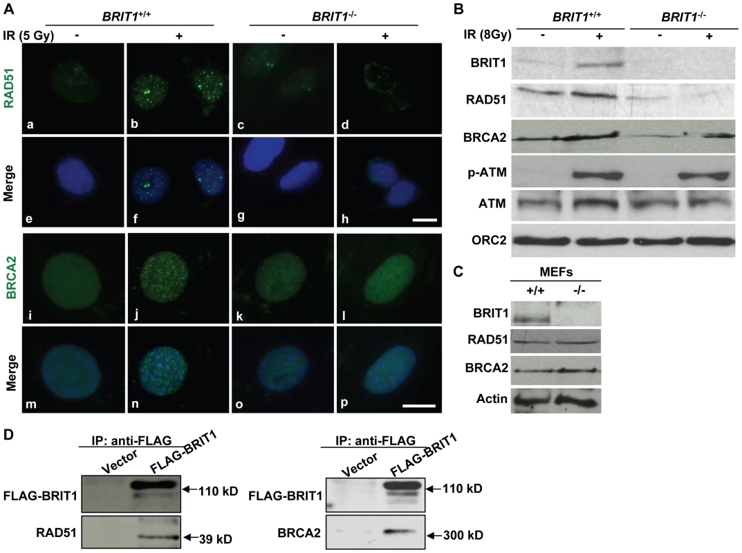 BRIT1 is required for recruitment of RAD51/BRCA2 to the IR-induced DNA damage sites.