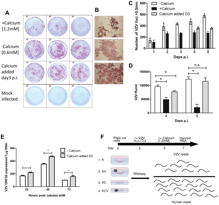 VZV infection of primary keratinocytes.