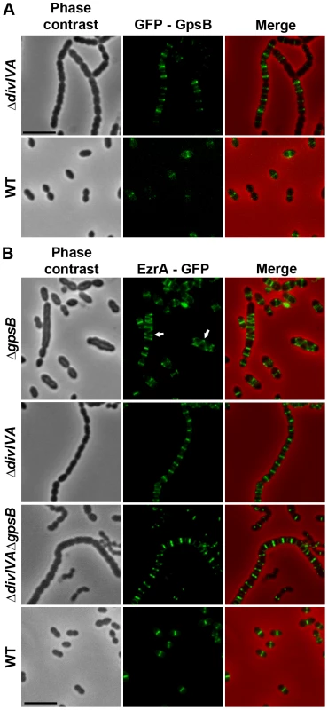 Localization of GpsB and EzrA.