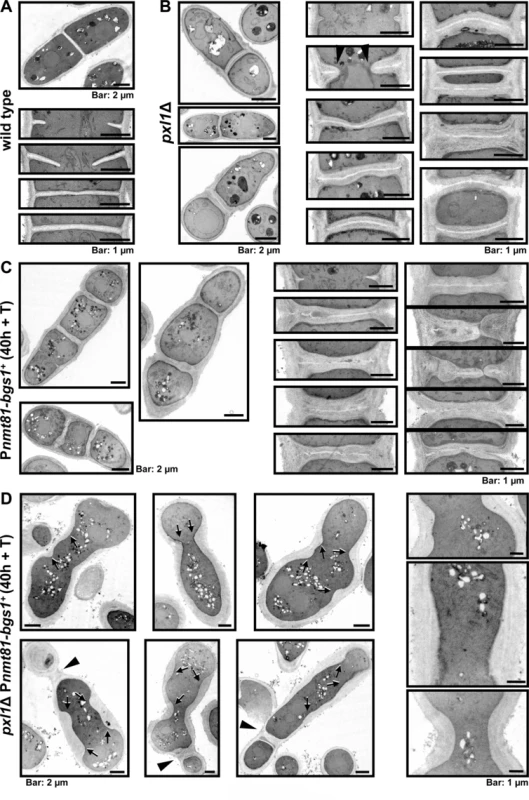 Bgs1 and Pxl1 cooperation is essential for the septum synthesis.