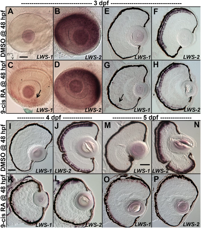 Changes in spatiotemporal patterns of expression of <i>LWS1</i> and <i>LWS2</i> in response to 9-cis RA treatment.