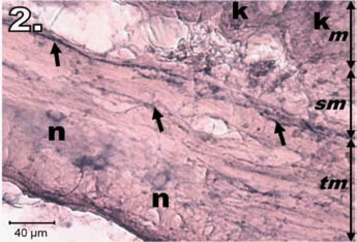 Histologický obraz jejuna v skupine R1. n – poškodené NADPH-d pozitívne neuróny slabo ofarbené, šípky – nervové vlákna slabo ofarbené, k – Lieberkühnove krypty negatívne, m – mukóza, sm – submukóza, tm – tunica muscularis; scale bar = 40 μm
Fig. 2. Histological picture of jejunum in group R1. n – damaged lightly stained NADPH-d positive neurons, arrows – lightly stained nerve fibres, k – negativity in Lieberkühn's crypts, m – mucosa, sm – submucosal layer, tm – tunica muscularis; scale bar = 40 μm