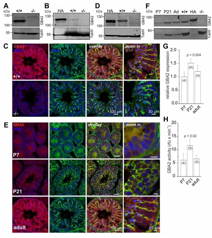 GBA2 is expressed in Sertoli cells.