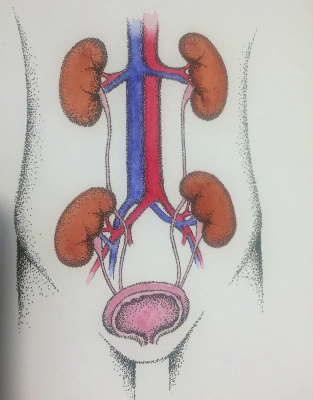 Oboustranná technika DKT
Fig. 2: Bilateral technique of DKT
(kresba MUDr. Táňa Matoušková)