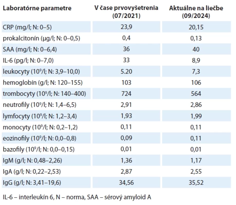 Laboratórne parametre u pacientky č. 1 na pred liečbou a na anticytokínovej liečbe.