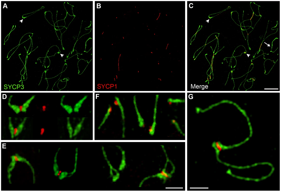 Centromere-associated SC fragments during diplonema.