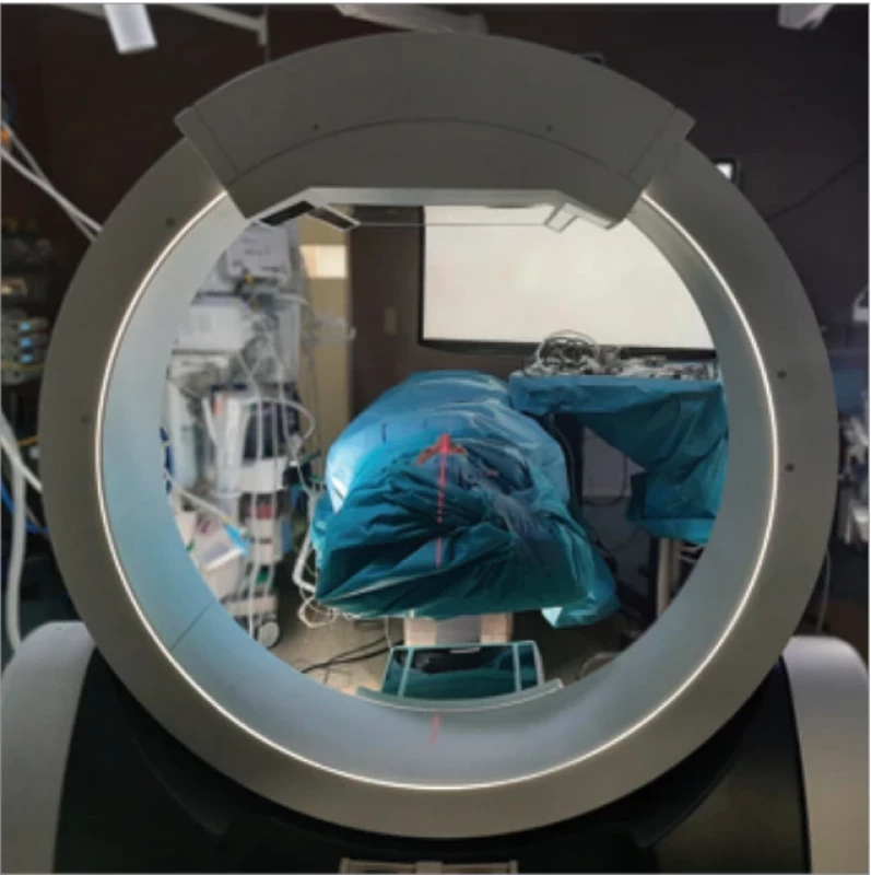 Preparation of the surgical fi eld before image aquisition.