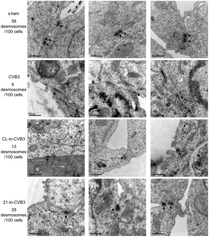 21-in rescues desmosome structures during CVB3 infection.