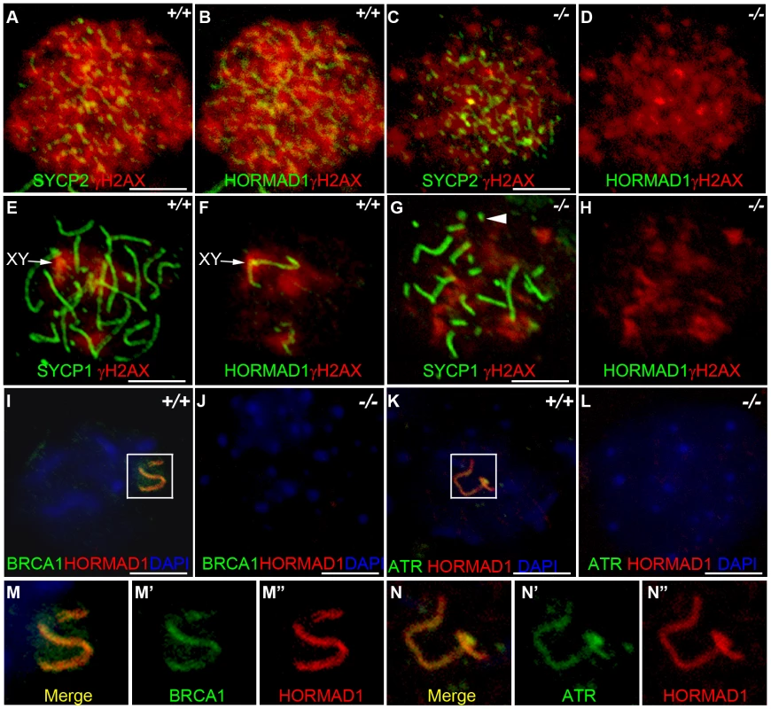 HORMAD1 disrupts γH2AX, BRCA1, and ATR localization to the XY chromosomes.