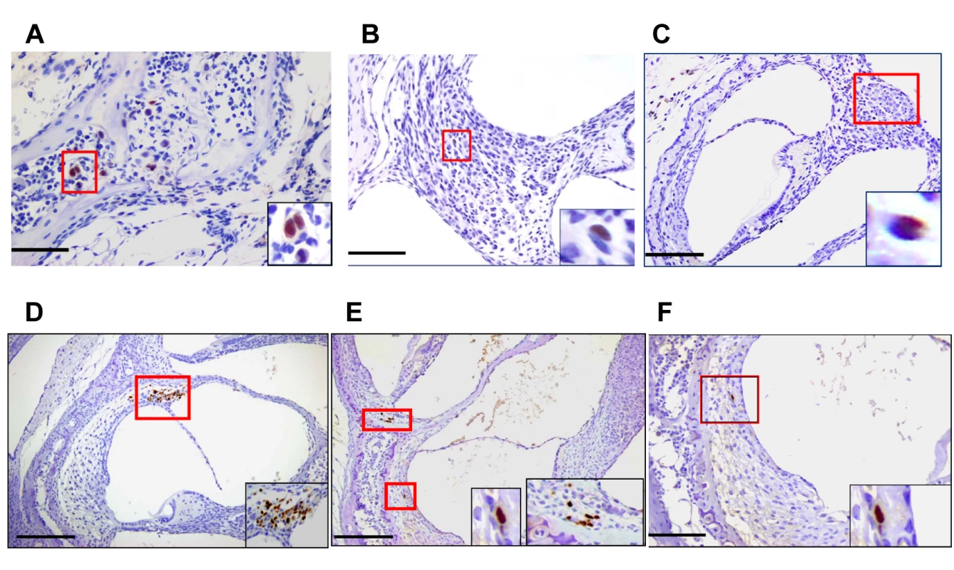 Detection of MCMV infected cells in the inner ear of MCMV infected mice.