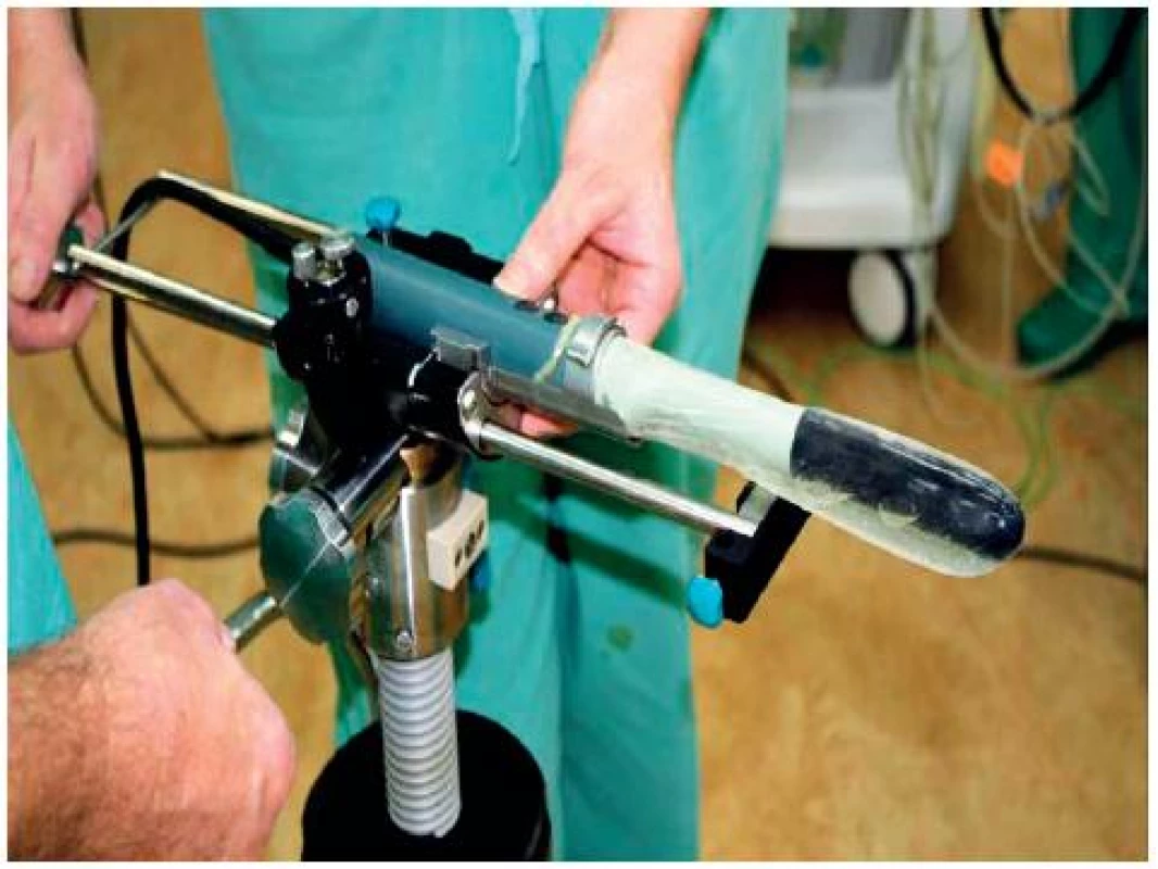 UZ sonda BK Medical v aretovaném postavení
