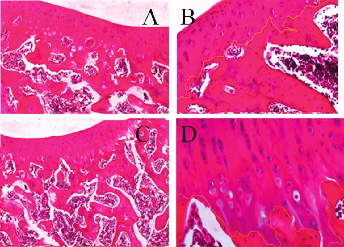 Histologické vyšetření kloubů.
A – přehledný obraz uspořádání struktur kloubní chrupavky a komponent subchondrální kosti (ploténka a trámce) v kontrolním intaktním kolenním kloubu distální končetiny králíka – šestý týden experimentu (barvení hematoxylin – eozinem (HE), zvětšení 40x). 
B – detailní pohled na stratifikaci a diferenciaci chondrocytů v kloubní chrupavce, včetně pravidelné linie průběhu kontaktní zóny se subchondrální kostí v intaktním kolenním kloubu, světle zvýrazněná linie (barvení HE, zv. 100x). 
C – řez kolenním kloubem distální končetiny králíka šestý týden po experimentálním ovlivnění bupivicainem a následnou aplikací PAGA.V kloubní chrupavce je patrná vystupňovaná diferenciace kolumnárního uspořádání chondroblastů a chondrocytů, linie kontaktu bazálních úseků chrupavky a komponent subchondrální kosti má pilovitý průběh (barvení HE, zv. 40x).
D – detailní zobrazení z předchozího řezu – světlá linie vyznačuje nepravidelnosti kontaktní zóny kloubní chrupavka – subchondrální kost (barvení HE, zv. x200).
