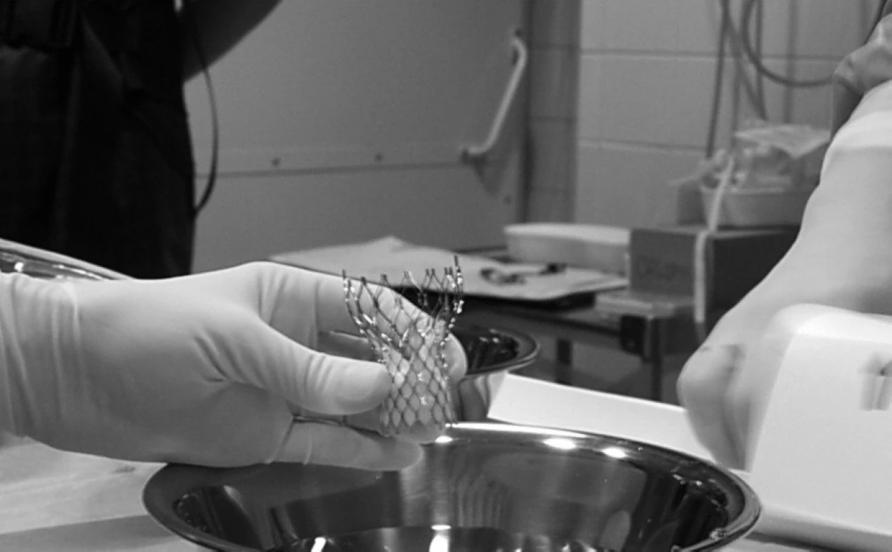 Celkový pohled na chlopenní náhradu Corevalve<sup>®</sup>