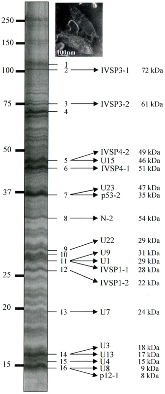 HdIV particle proteins identified by mass spectrometry and sequence searches using the translated sequences of the three IVSPER genes (16 bands were analyzed).