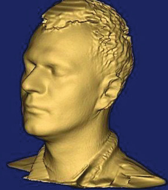Vytváranie replík pomocou 3D skenerov.