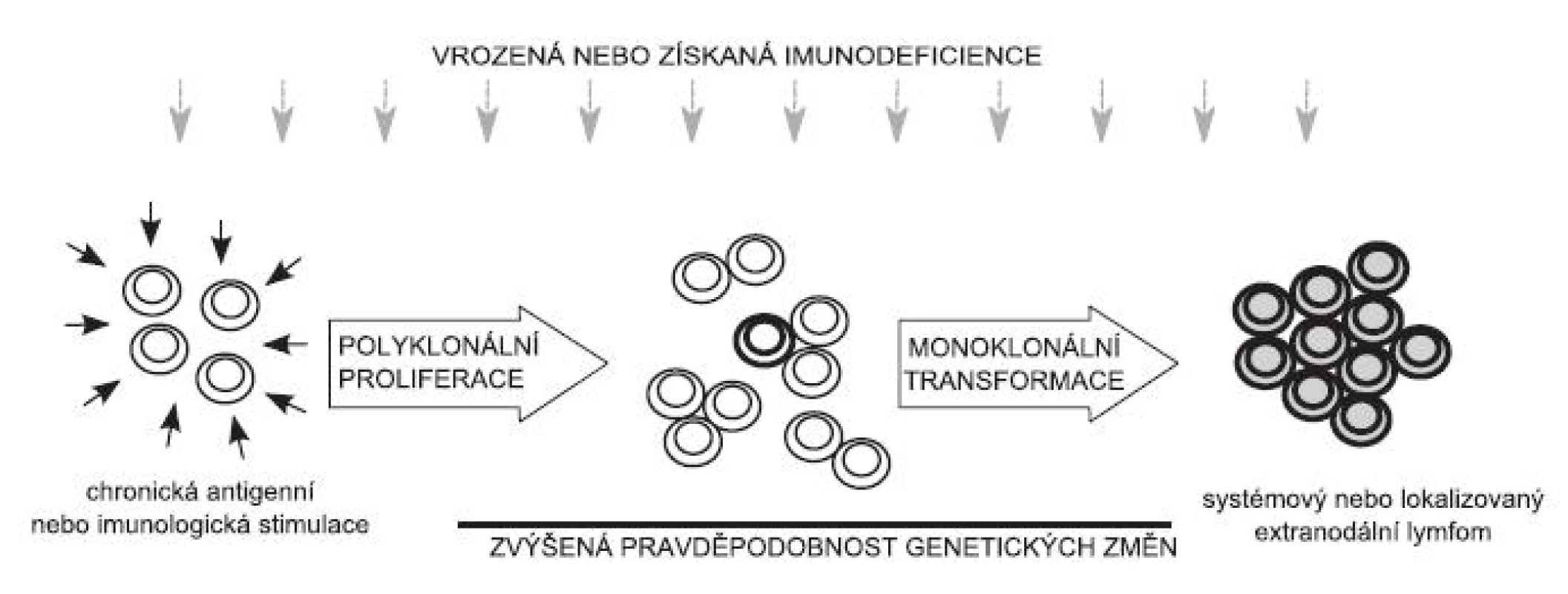 Schéma možného vývoje maligních lymfoproliferací založeného na chronické antigenní stimulaci: Chronická antigenní nebo imunologická stimulace vede ke zvýšené proliferaci velkého počtu klonů lymfocytů. Pokud dojde v jedné buňce (několika buňkách) k nahromadění mutací vedoucích k její nádorové transformaci, vzniká klon (případně několik klonů) nádorových lymfocytů, který dá vznik malignímu lymfomu. Za podmínek vrozené nebo získané imunodeficience se proces lymfomageneze výrazně zrychluje.

