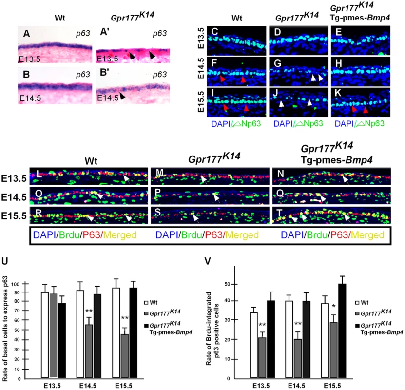 Transgenically expressed <i>Bmp4</i> in <i>Gpr177<sup>K14</sup></i> mutants rescued the defective p63 expression.