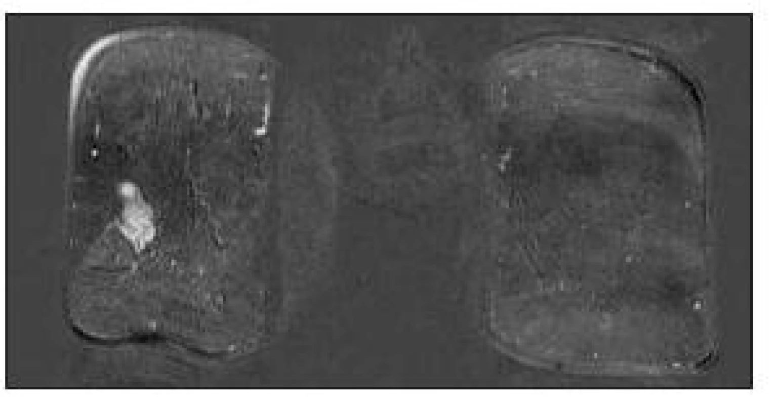 Magnetická rezonance
Fig. 4. Magnetic resonance imaging