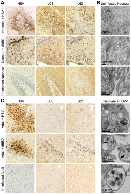 Autophagy in the CNS is activated in the neonatal mouse during HSV infection, but is effectively inhibited in the adult.
