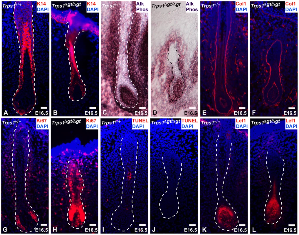<i>Trps1<sup>Δgt/Δgt</sup></i> vibrissae follicles exhibit increased levels of proliferation.
