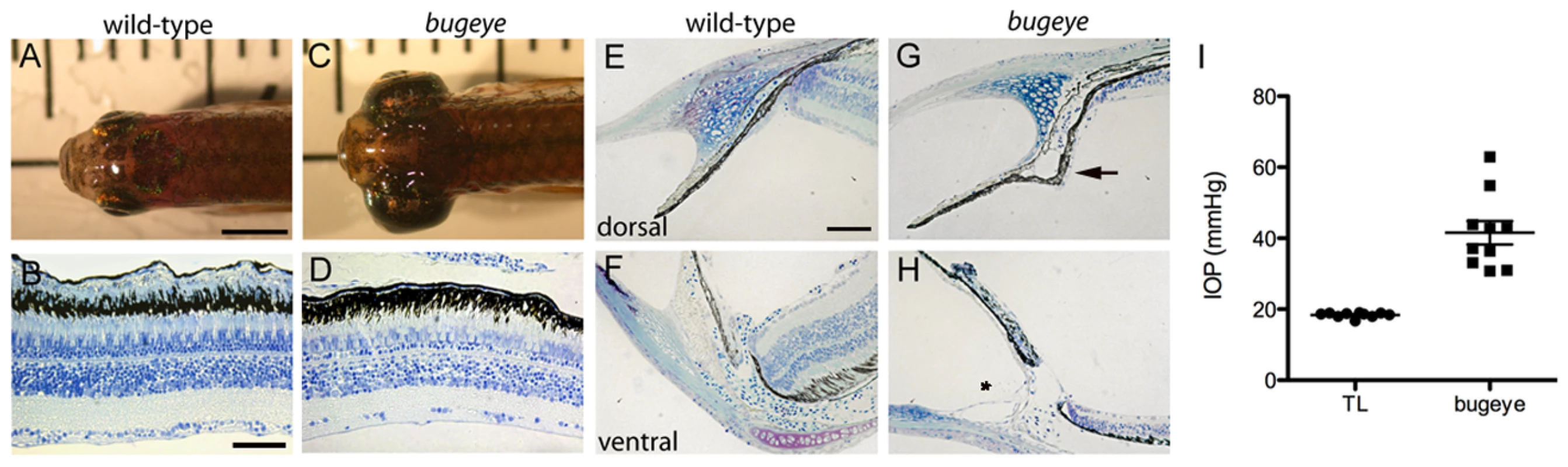 Adult <i>bugeye</i> zebrafish have enlarged eye globes, thinned retinas, and elevated intraocular pressure without iridocorneal angle obstruction or malformation.