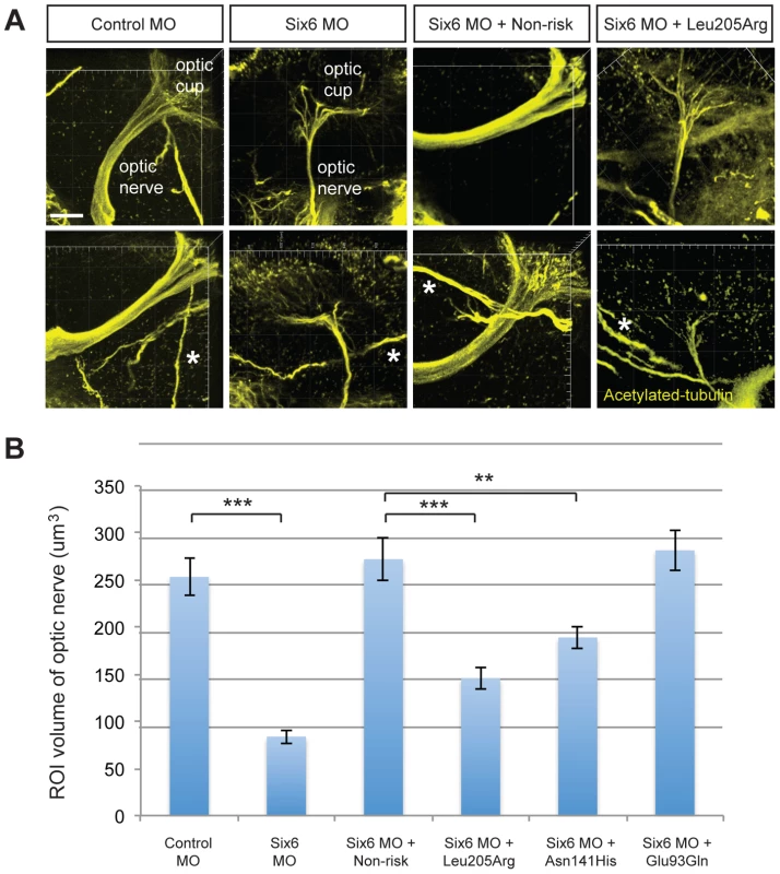 Functional evaluation of <i>SIX6</i> variants on the volume of the optic nerve.