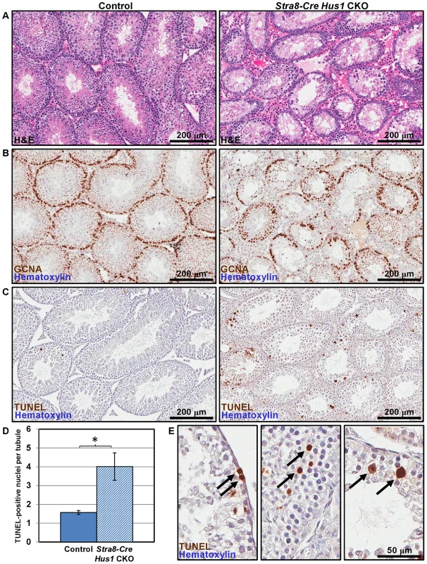 <i>Hus1</i> loss results in germ cell depletion.