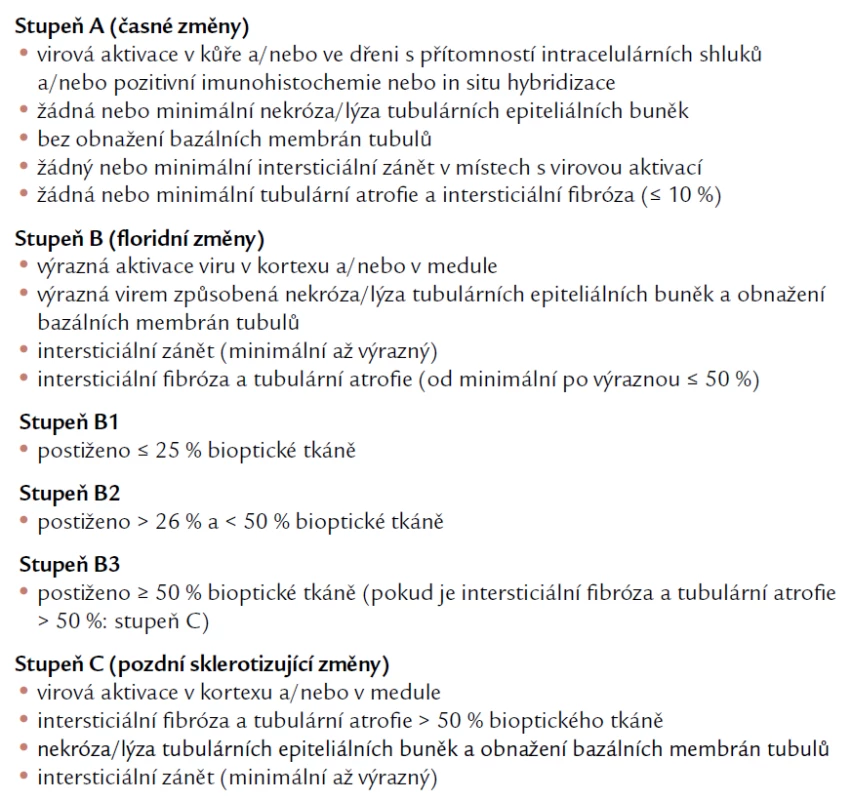 Histologické stupně BK virové nefropatie. Podle [19].