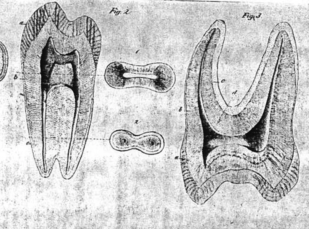 Ilustrace ze spisu M. Fraenkela.