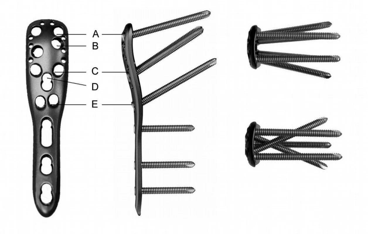 Dlaha Philos
