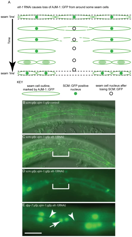 <i>elt-1</i> RNAi causes division-independent seam to hypodermis fate transitions.