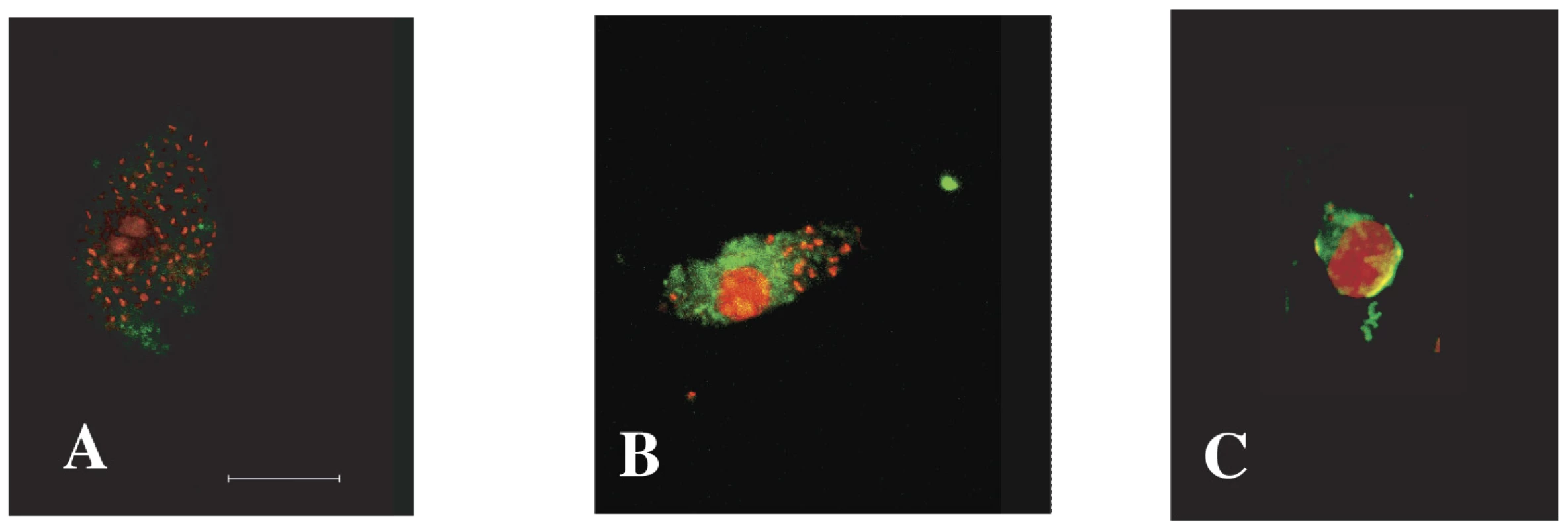 IL-12 expression.
