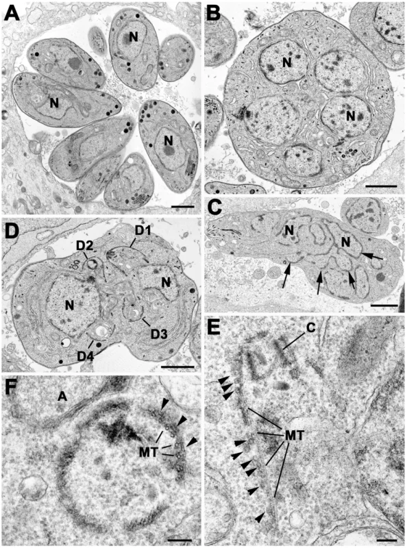 Electron micrographs of sections of <i>T. gondii</i> in fibroblast.