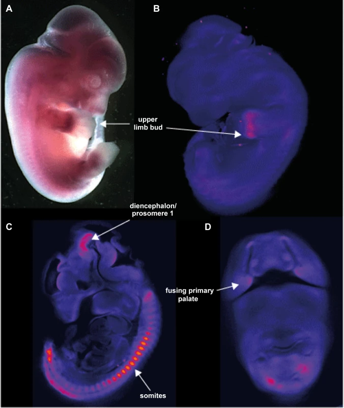 Site and stage specific expression of <i>Aff3</i> in mouse embryos.