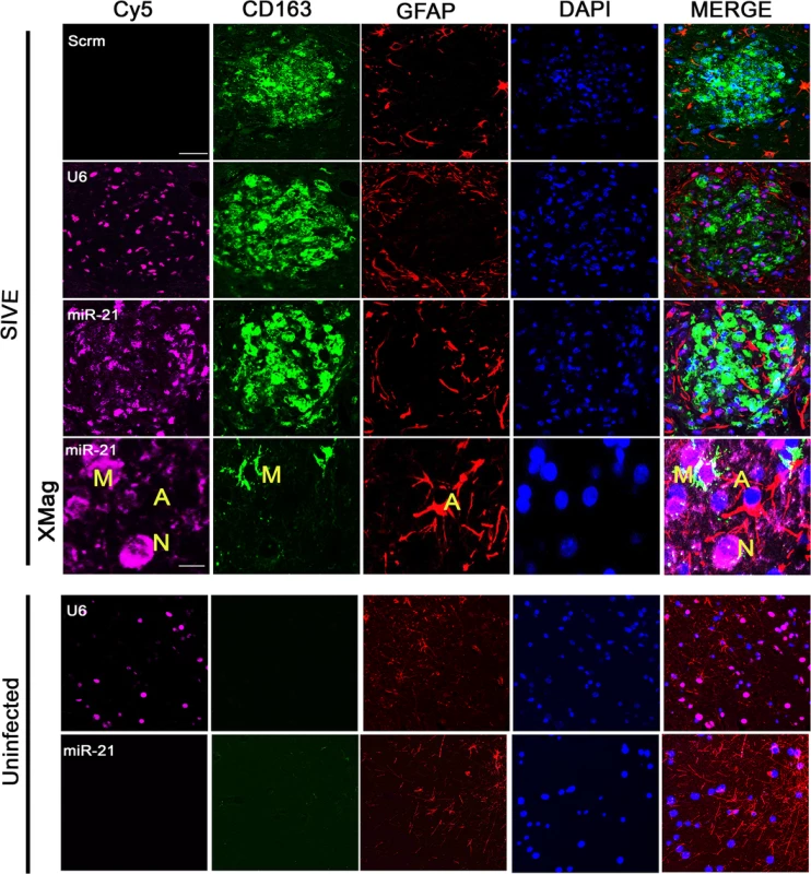 Combined FISH and IF for miR-21, CD163 and GFAP.