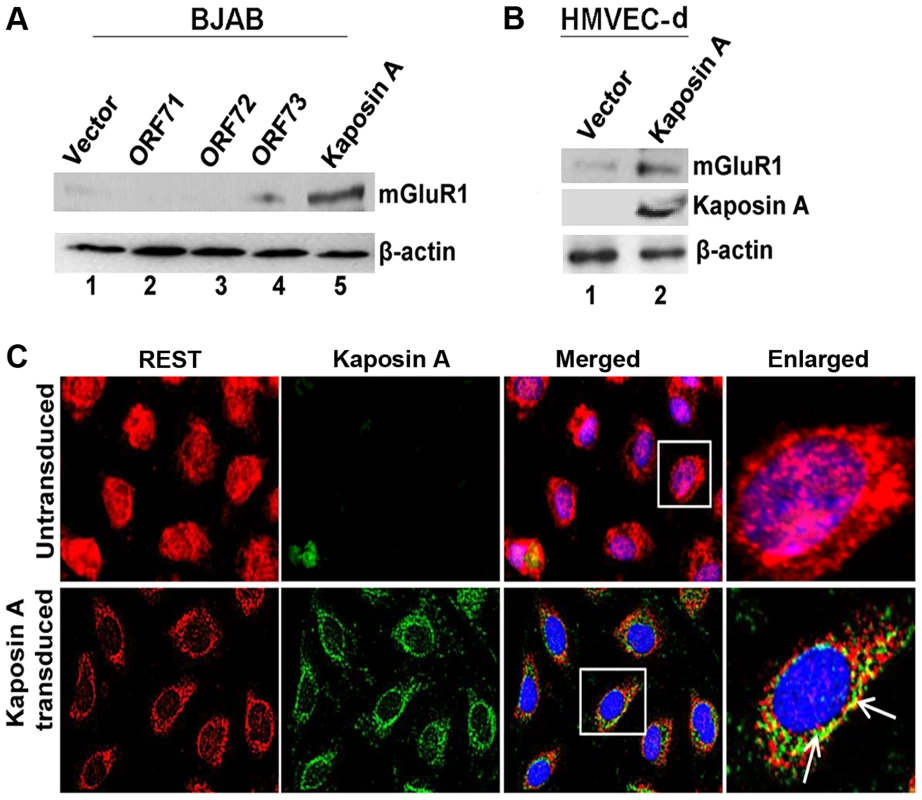 KSHV latency associated Kaposin A protein mediates mGluR1 expression.