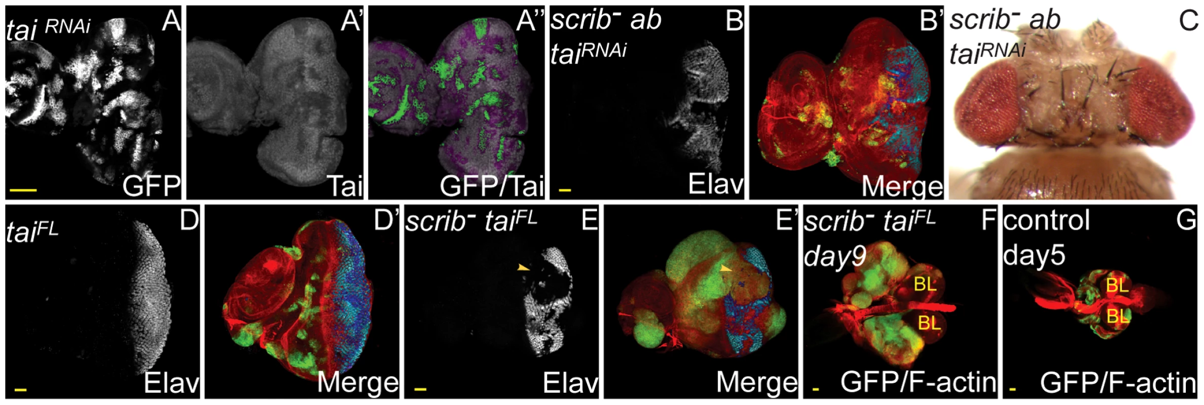 Tai is required for <i>scrib</i><sup>−</sup>+<i>ab</i> tumour overgrowth, and sufficient to cooperate with the loss of <i>scrib</i>.