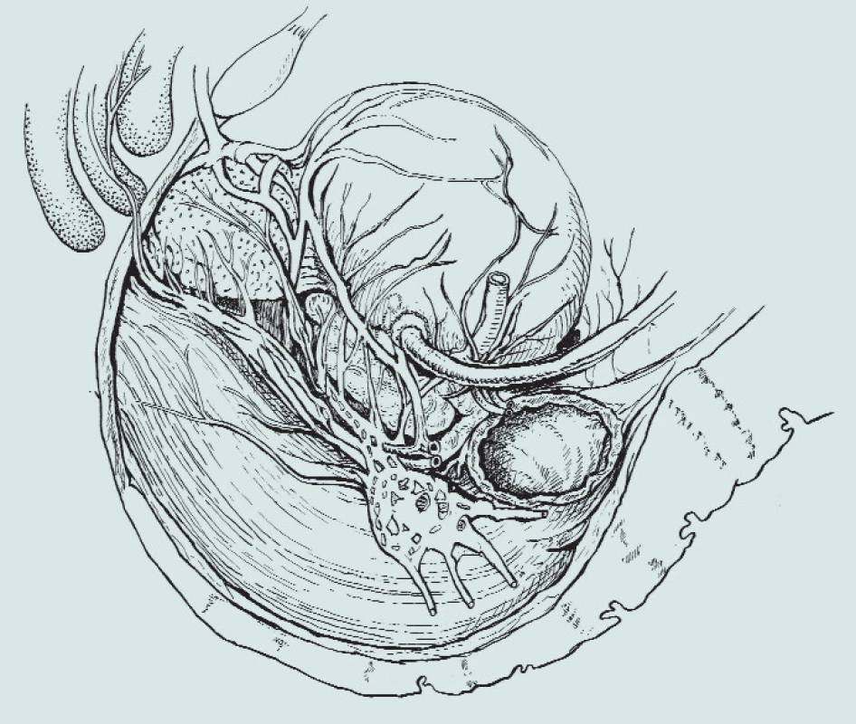 Anatomie pánve - průběh nervově-cévního svazku [4].