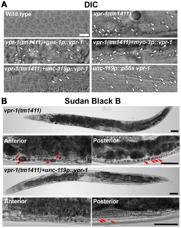 Effect of tissue-specific <i>vpr-1</i> expression on fat levels.