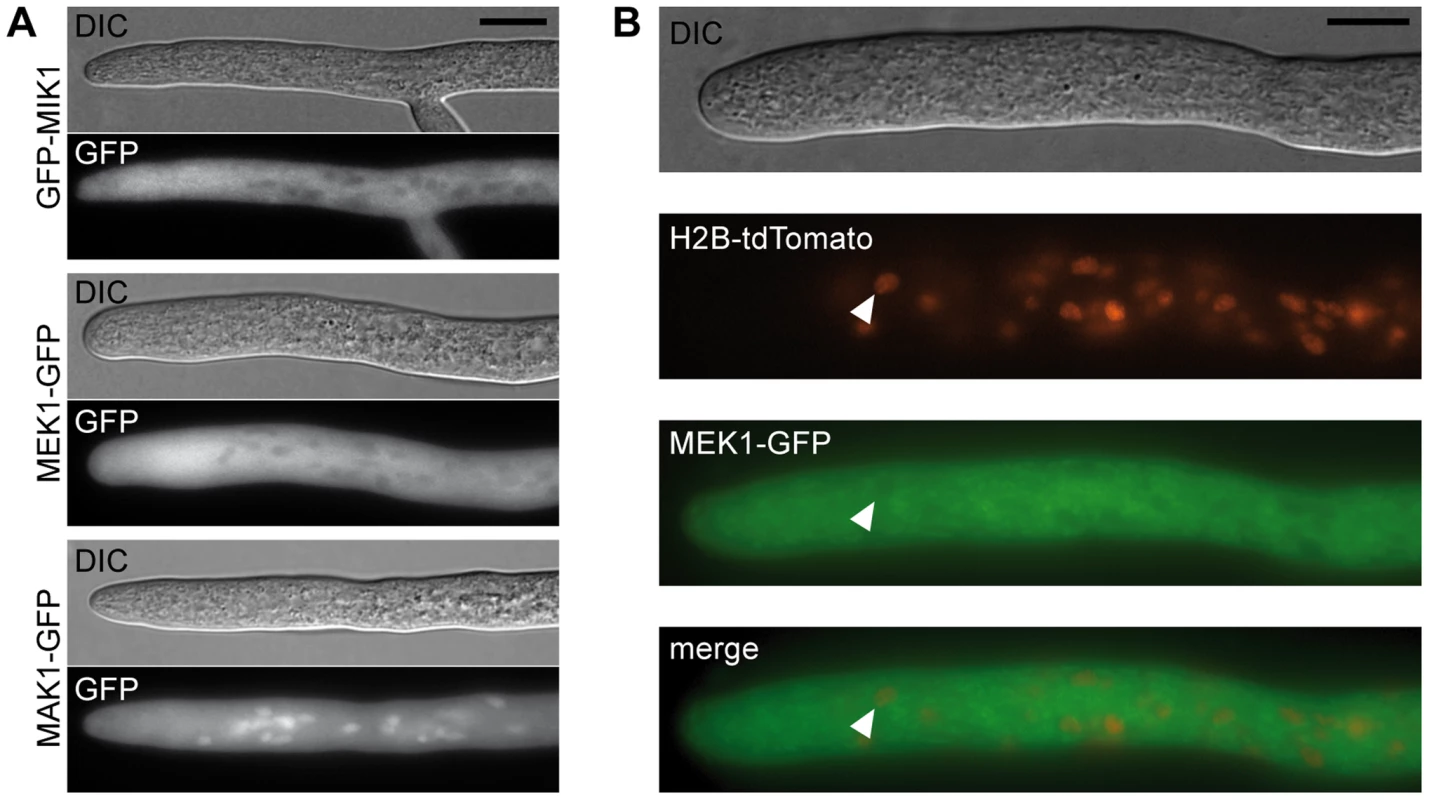 Localization of MIK1, MEK1, and MAK1.