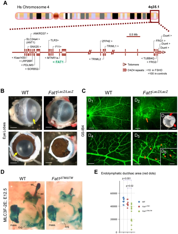 Selective changes in <i>Fat1</i> mutant mice recapitulate the clinical picture of FSHD.