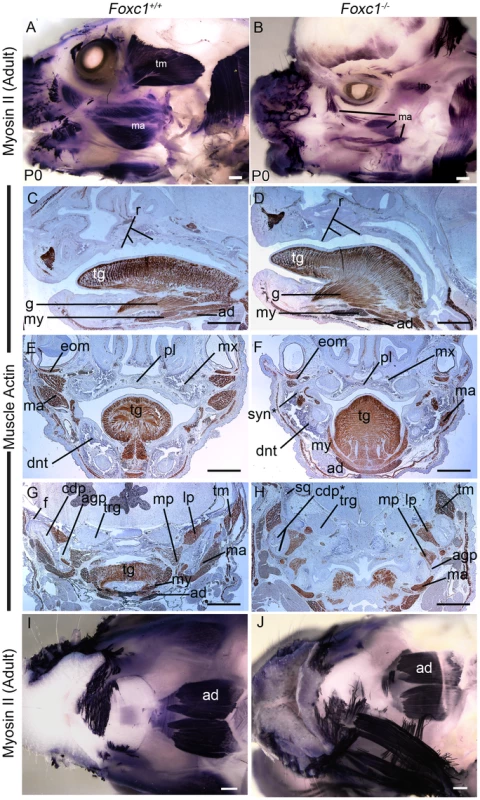Abnormalities of PA1 derived muscle in <i>Foxc1<sup>−/−</sup></i>.