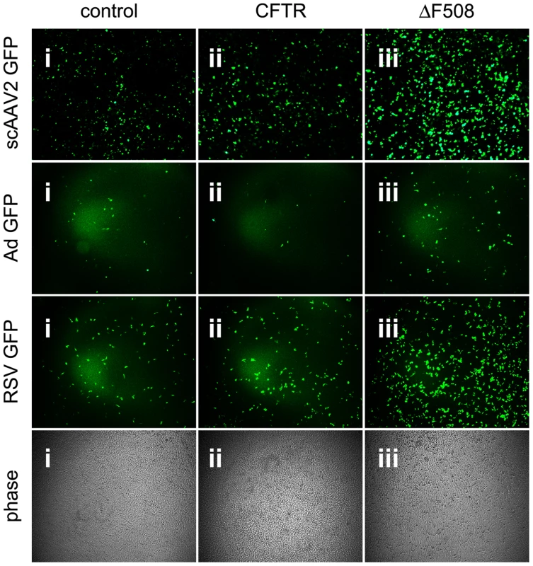 Cells expressing misfolded ΔF508-CFTR are more permissive to infection with human respiratory viruses.