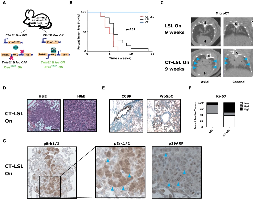 <i>Twist1</i> accelerates conditional <i>Kras<sup>G12D</sup></i>-induced lung tumorigenesis.