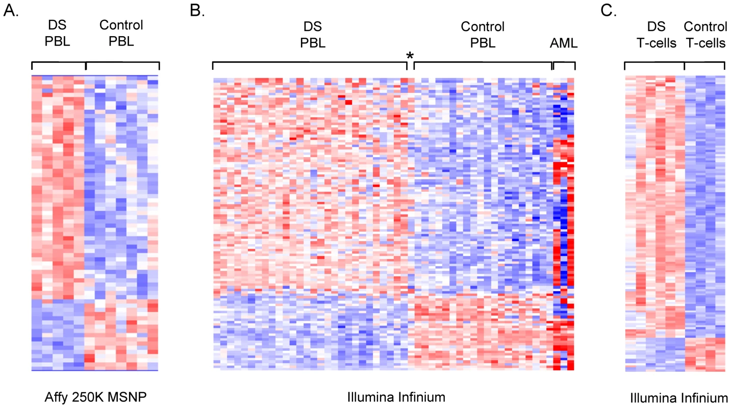 Microarray analysis of DNA methylation in DS versus normal PBL.