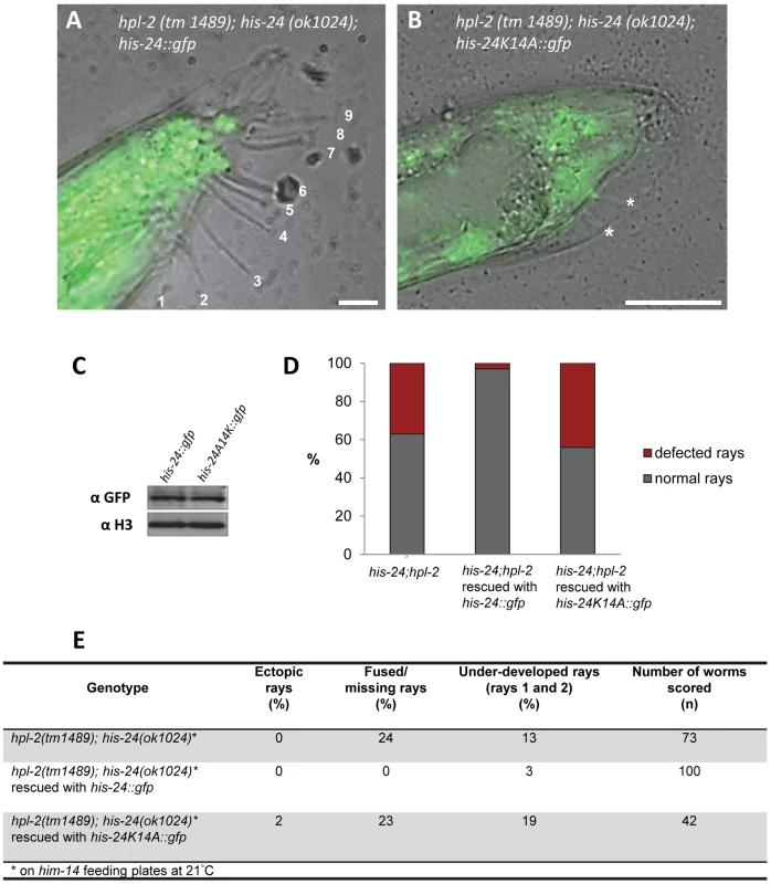 HIS-24::GFP expression in <i>hpl-2;his-24</i> double mutant animals restores normal male tail development.