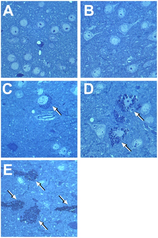 Light microscopy of neurons in deep cortex of wild type mice, single <i>Neu4<sup>−/−</sup></i> or <i>Hexa<sup>−/−</sup></i> knockouts and in double <i>Neu4<sup>−/−</sup>;Hexa<sup>−/−</sup></i> knockouts without and with seizures.