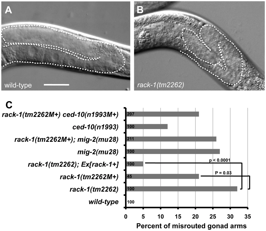 RACK-1 is required for gonadal distal tip cell migration.