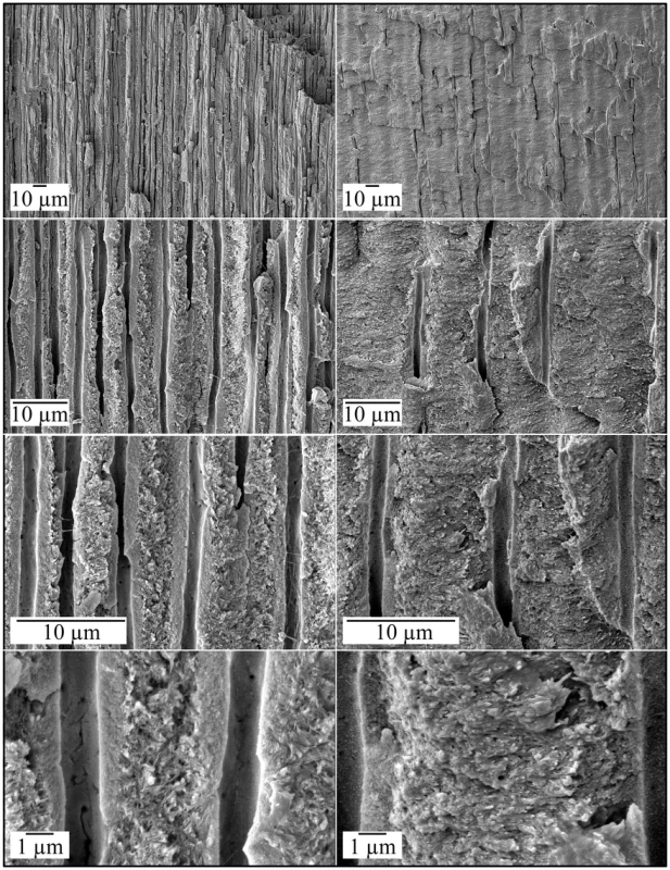 Scanning Electron Micrographs (SEMs) of dentin in a molar (#18) split for SEM examination.