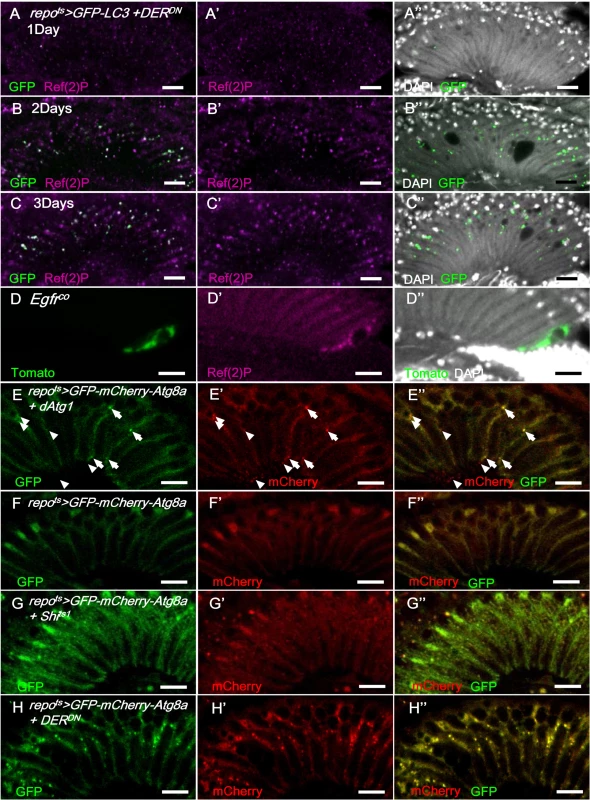 EGFR signaling is required for autophagosome-lysosomal trafficking.